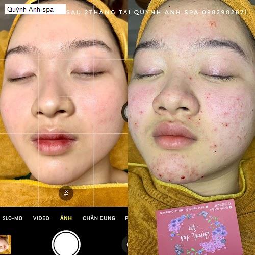 Hình ảnh Quỳnh Anh spa